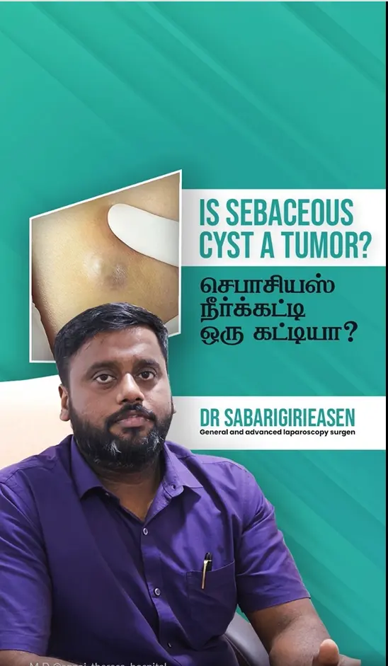 Sebaceous and Epidermal Cysts: When to See a Surgeon