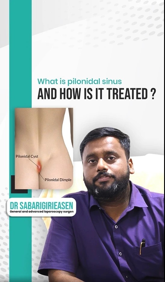 Pilonidal Sinus: Understanding and Treating Tailbone Pain